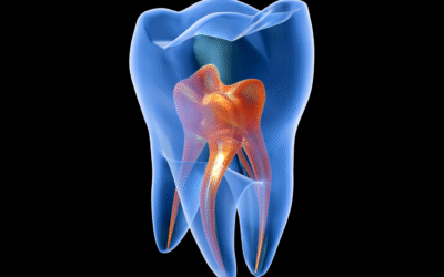 Células madres de la pulpa dental