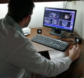 Todo lo que debes saber antes de iniciar un tratamiento con Implantes Dentales
