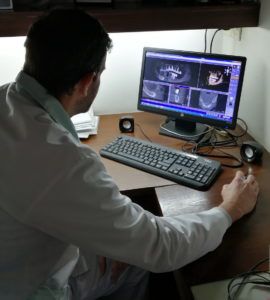 Todo lo que debes saber antes de iniciar un tratamiento con Implantes Dentales