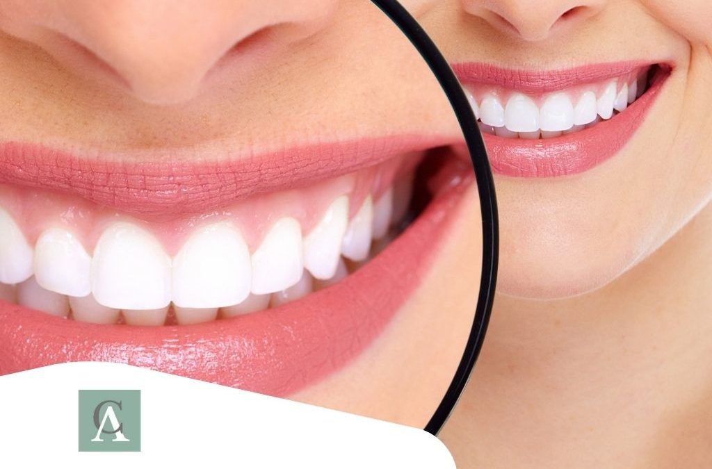 Cómo cuidar tus dientes para mantenerlos blancos
