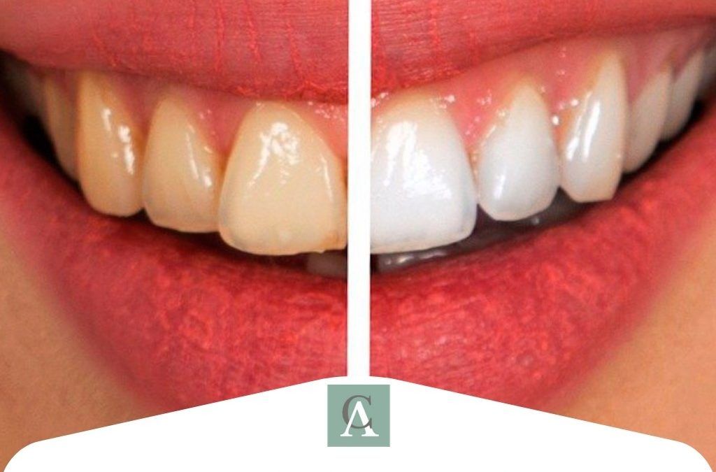 Odontología cosmética o estética