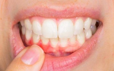 Enfermedad Periodontal y su relación con otras enfermedades