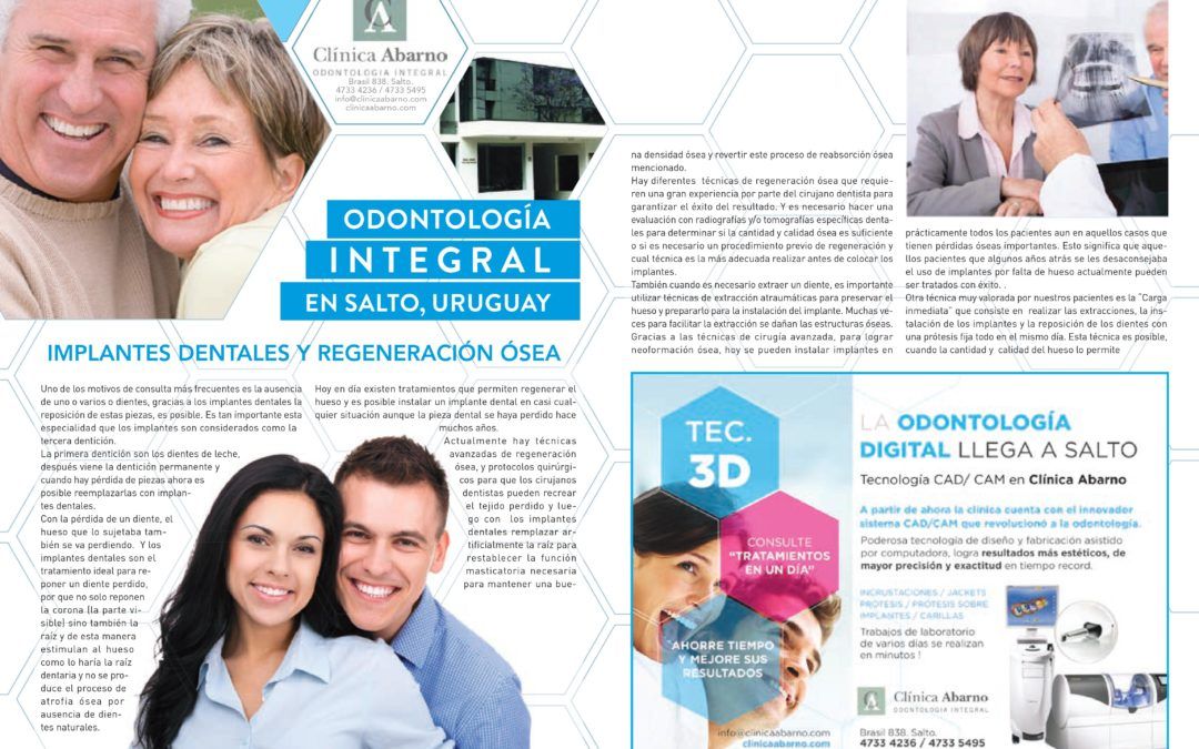 Implantes dentales y regeneración ósea