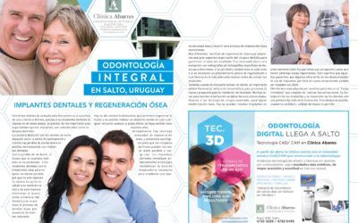 Implantes dentales y regeneración ósea